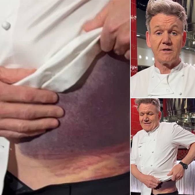 Gordon Ramsay shares important message after potentially fatal accident