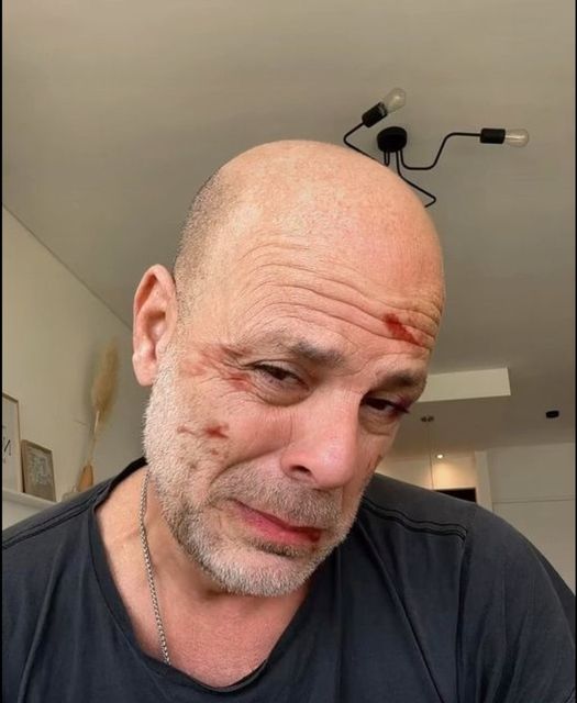 Bruce Willis’ wife Emma Heming shares heartbreaking video of him after his dementia diagnosis
