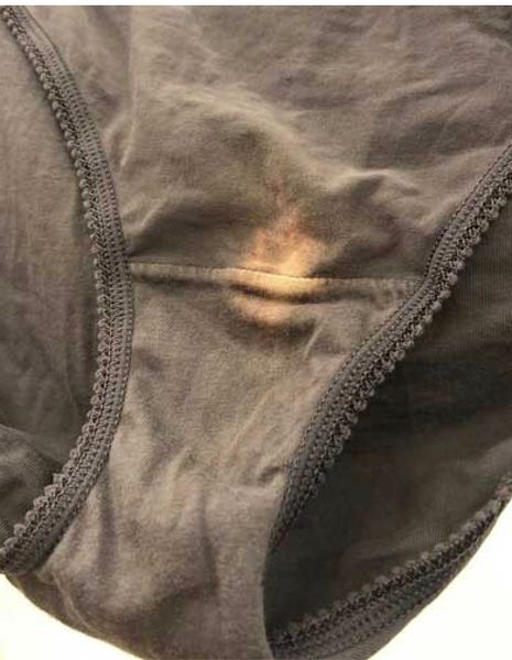 This is what it means if you find a “bleach” spot on your underwear